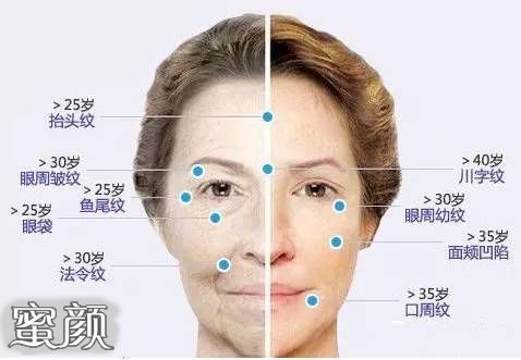 https://img.miyanlife.com/mnt/Editor/2021-12-31/61ceced503c58.jpg