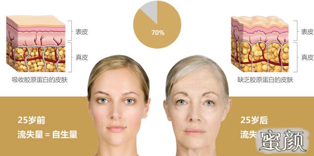 https://img.miyanlife.com/mnt/Editor/2022-01-04/61d432d8204c9.jpg