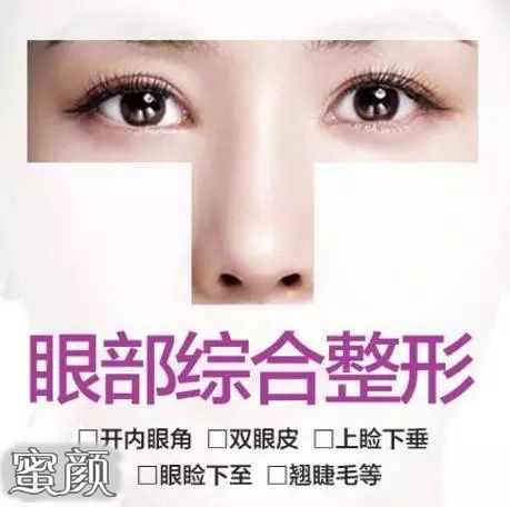 https://img.miyanlife.com/mnt/Editor/2022-01-18/61e696192cdee.jpg