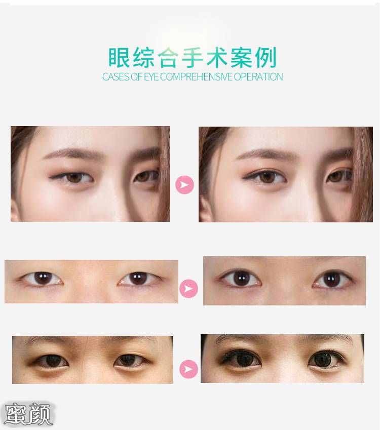 https://img.miyanlife.com/mnt/Editor/2022-01-18/61e696197473b.jpg