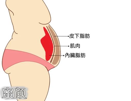 啤酒肚脂肪解剖图图片