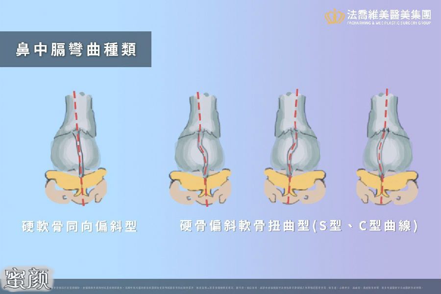 案例图片