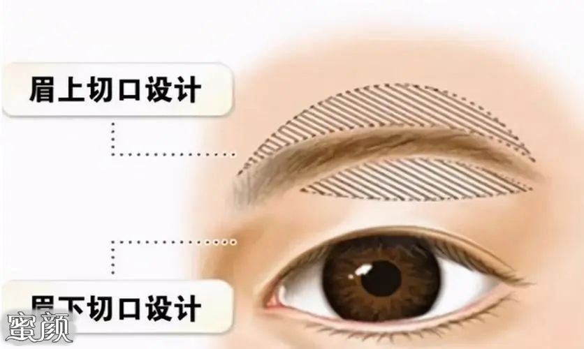 https://img.miyanlife.com/mnt/Editor/2022-02-02/61fa87f9b7097.jpg