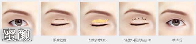 https://img.miyanlife.com/mnt/Editor/2022-02-02/61fa88090b20d.jpg