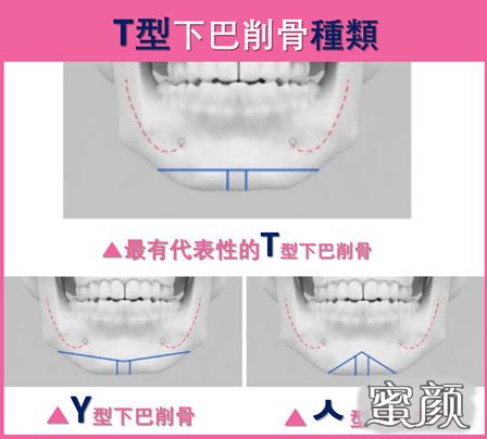 案例图片