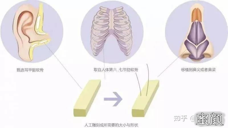 案例图片