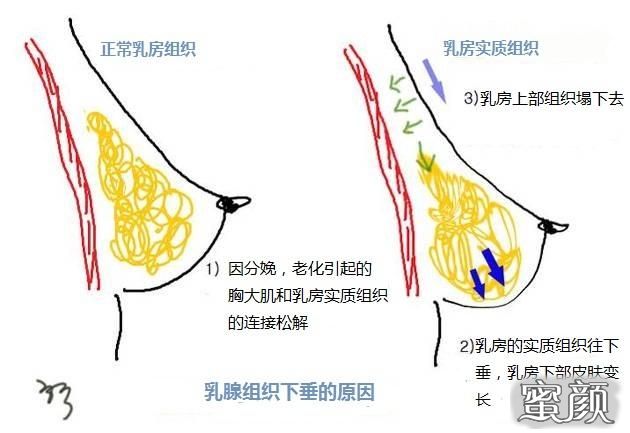 案例图片