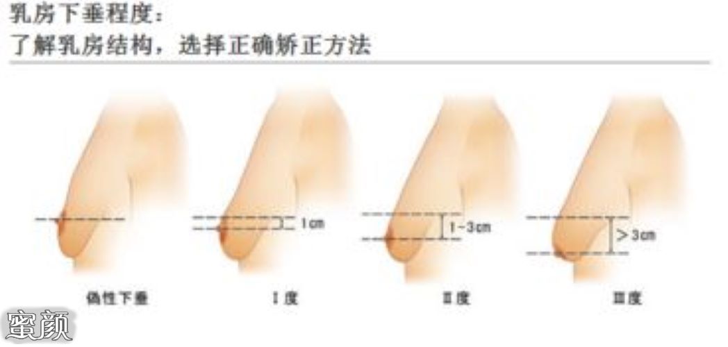 案例图片