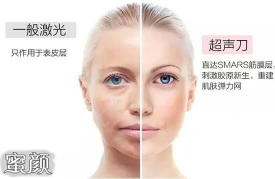 https://img.miyanlife.com/mnt/Editor/2022-02-19/62103c31eda29.jpg