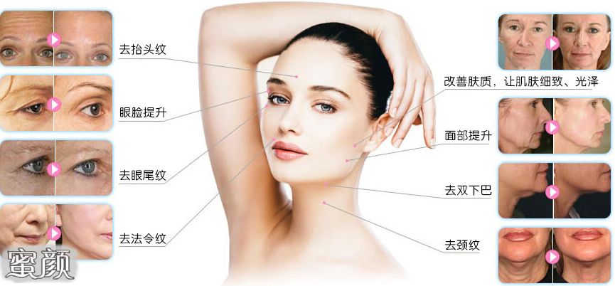 https://img.miyanlife.com/mnt/Editor/2022-02-19/62103c3b74375.jpg