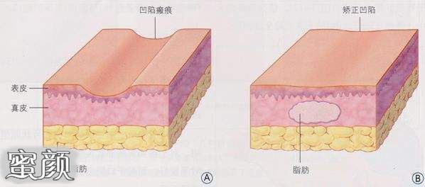 案例图片