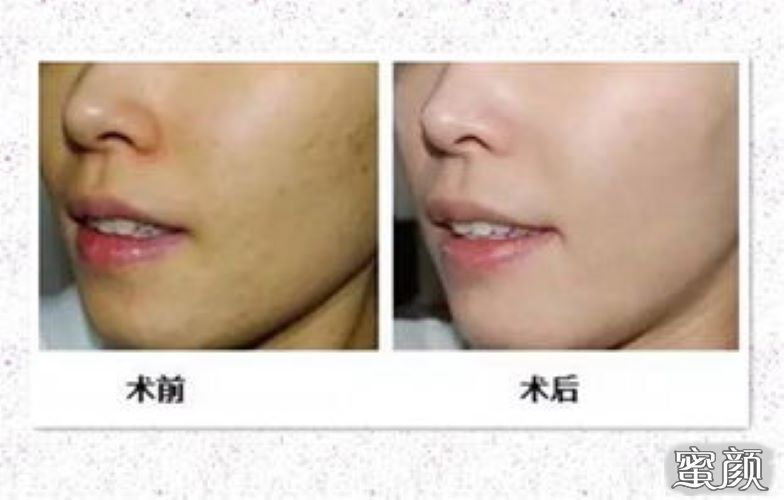 https://img.miyanlife.com/mnt/Editor/2022-03-11/622b103805fe9.jpg