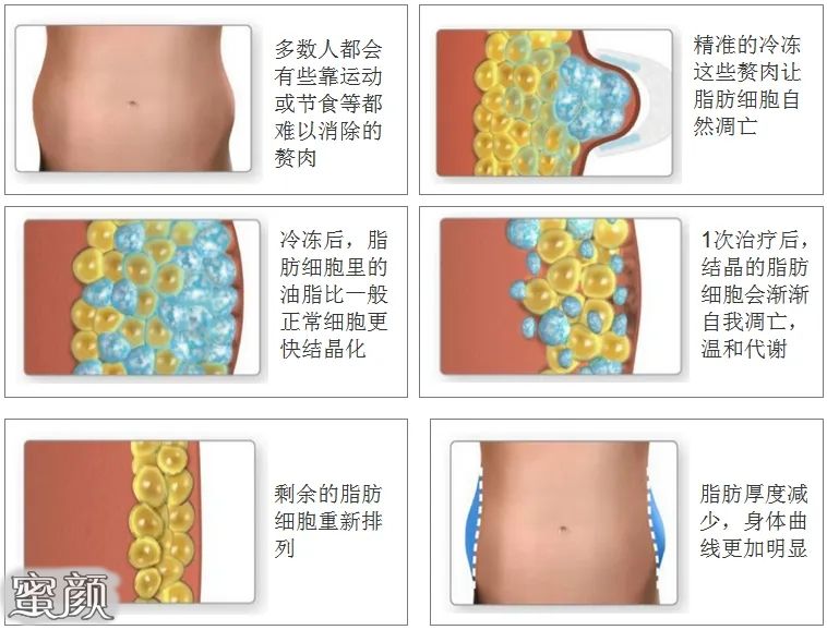 案例图片