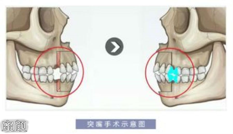 案例图片