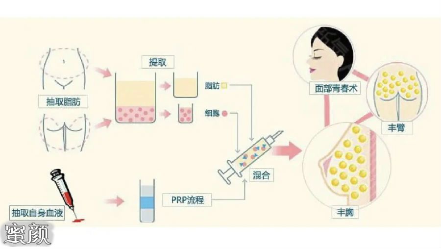 案例图片