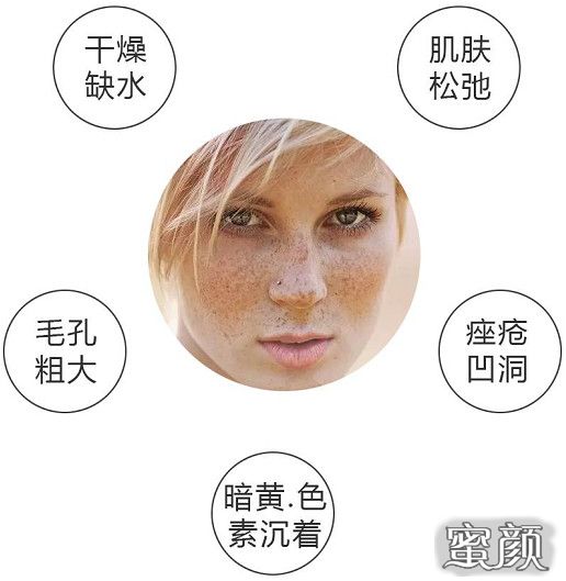https://img.miyanlife.com/mnt/Editor/2022-04-24/62654ae4cfd94.jpg