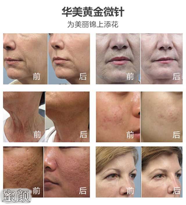 https://img.miyanlife.com/mnt/Editor/2022-04-24/62654af31069e.jpg