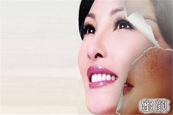 https://img.miyanlife.com/mnt/Editor/2022-04-24/6265692499b0d.jpg