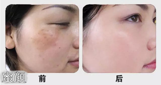 https://img.miyanlife.com/mnt/Editor/2022-04-24/6265692dbd966.jpg
