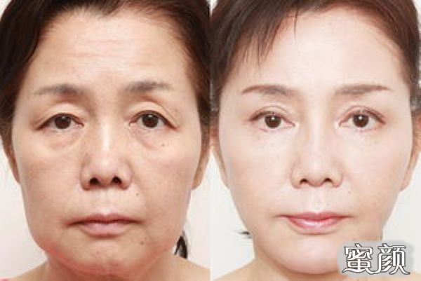 https://img.miyanlife.com/mnt/Editor/2022-05-23/628b8ebee8540.jpg