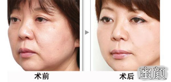 https://img.miyanlife.com/mnt/Editor/2022-06-02/6298c37cd46d9.jpg