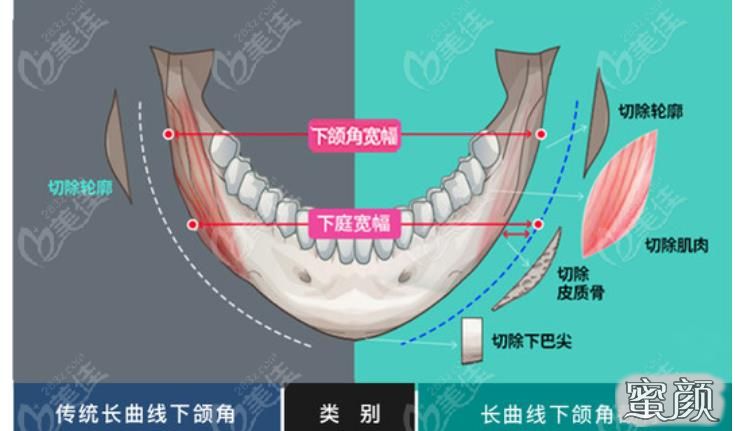 案例图片