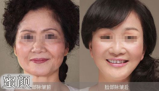 https://img.miyanlife.com/mnt/Editor/2022-06-27/62b8db432eaa2.jpg