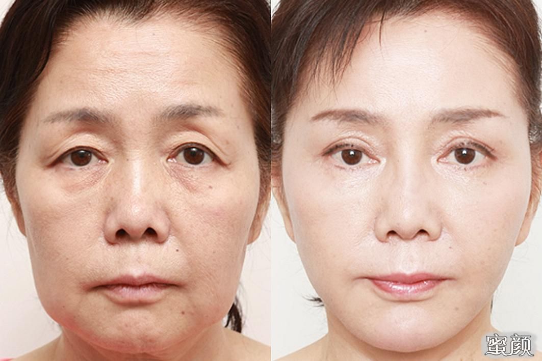 https://img.miyanlife.com/mnt/Editor/2022-06-27/62b8db4cd4058.jpg