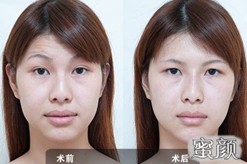 https://img.miyanlife.com/mnt/Editor/2022-06-27/62b8f424cce7e.jpg