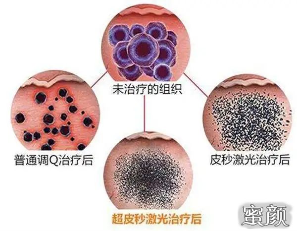 案例图片