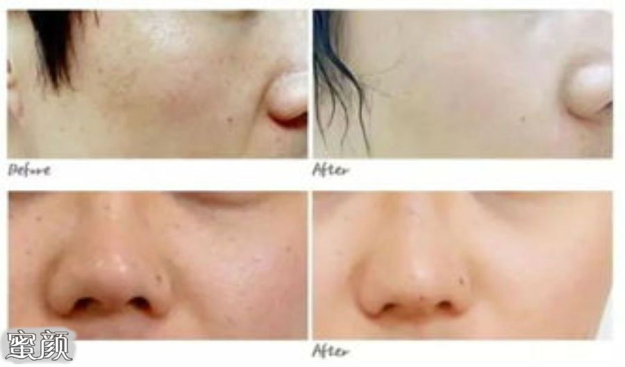 https://img.miyanlife.com/mnt/Editor/2022-07-01/62be9fe50f38d.jpg