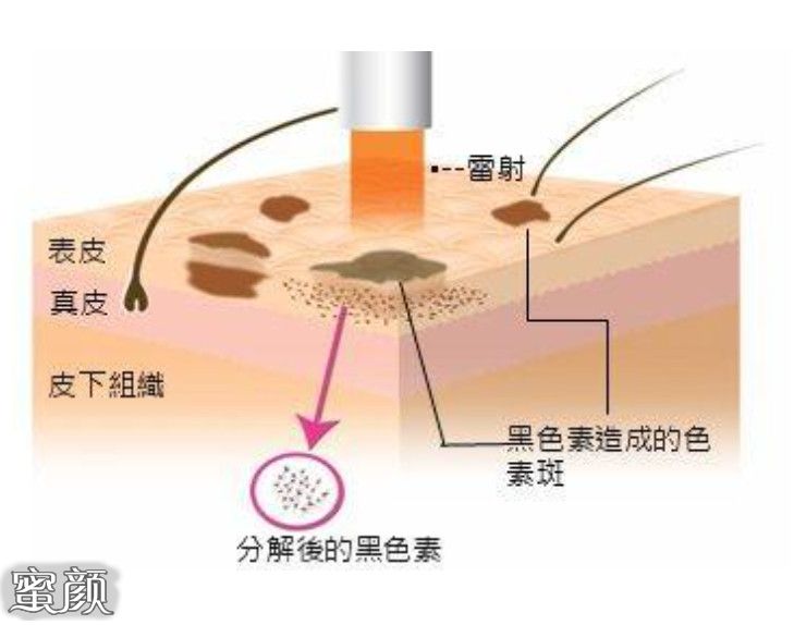 案例图片