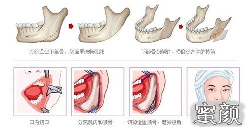 案例图片