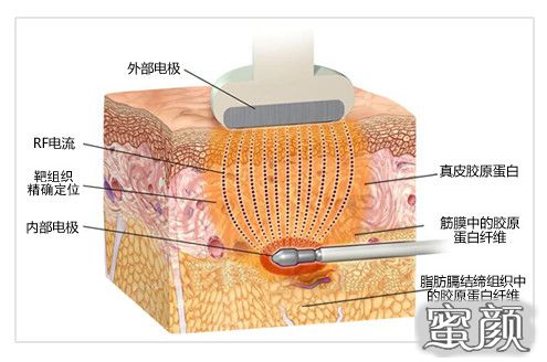 案例图片