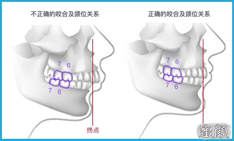 案例图片