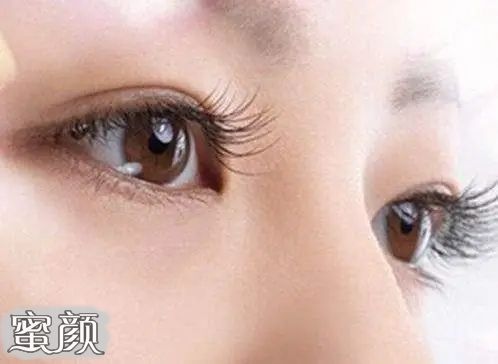 https://img.miyanlife.com/mnt/Editor/2022-08-11/62f5050f53208.jpg