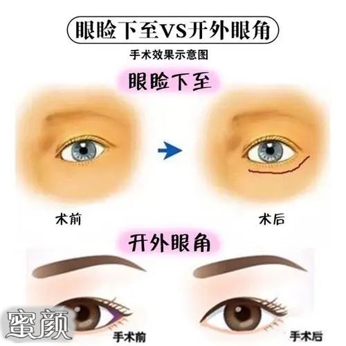 https://img.miyanlife.com/mnt/Editor/2022-08-17/62fcc41f93275.jpg