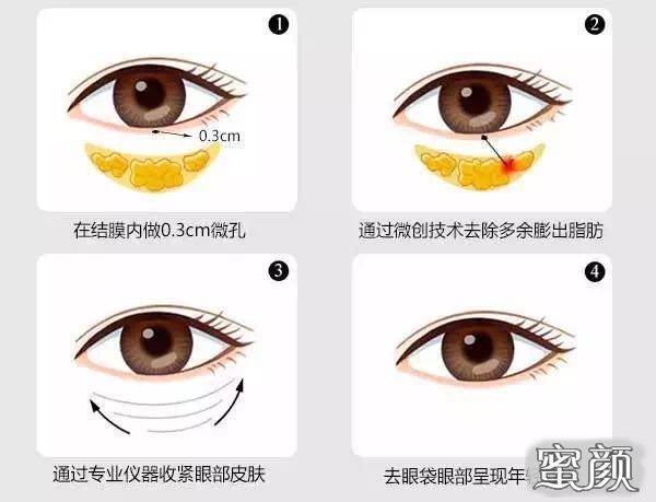 https://img.miyanlife.com/mnt/Editor/2022-08-23/6304a37069208.jpg