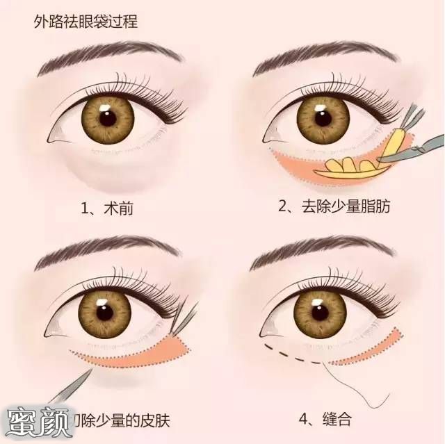 https://img.miyanlife.com/mnt/Editor/2022-08-23/6304a397c52f9.jpg