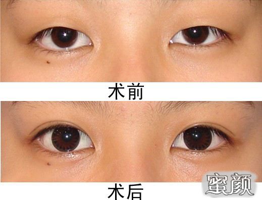 https://img.miyanlife.com/mnt/Editor/2022-08-28/630b290e207f8.jpg