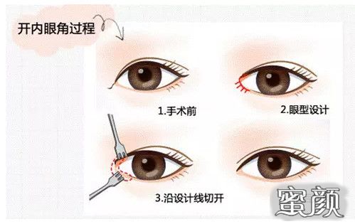 https://img.miyanlife.com/mnt/Editor/2022-08-28/630b292ea41c5.jpg