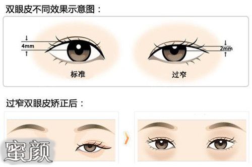 https://img.miyanlife.com/mnt/Editor/2022-08-28/630b2963ad229.jpg