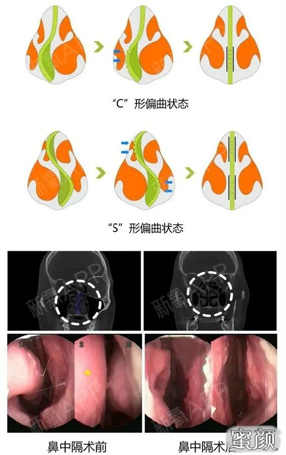 案例图片