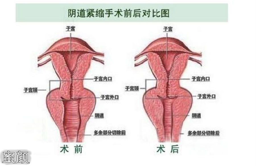 案例图片