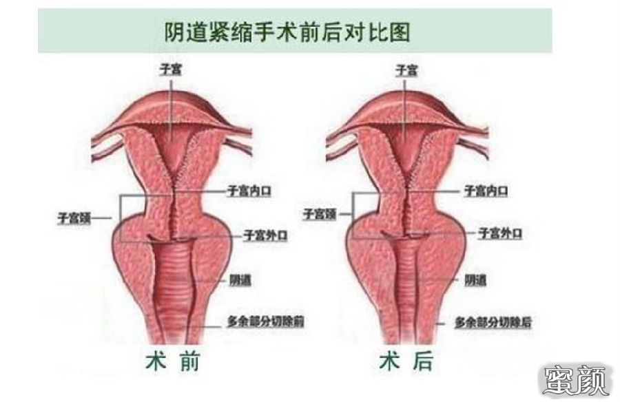 案例图片