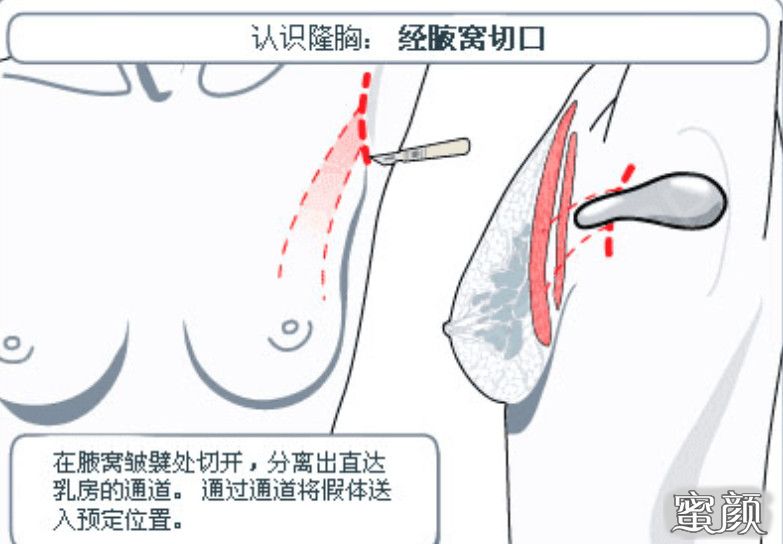 案例图片