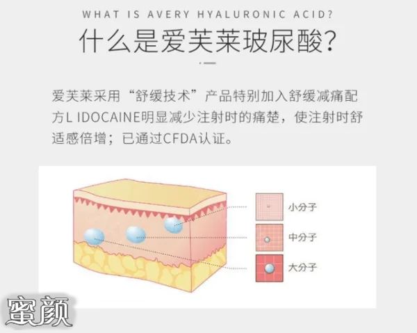 https://img.miyanlife.com/mnt/Editor/2022-10-09/63427f3d7ecc7.jpg