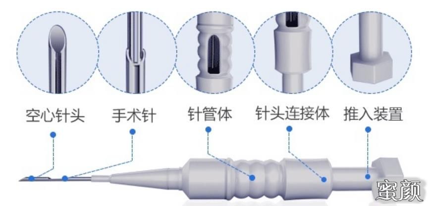 案例图片