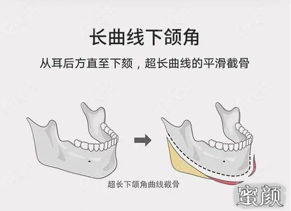 案例图片