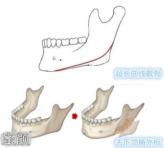 案例图片